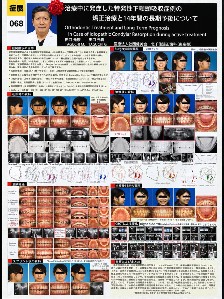 100周年記念第85回日本矯正歯科学会学術大会にて優秀演題賞受賞｜北千住矯正歯科